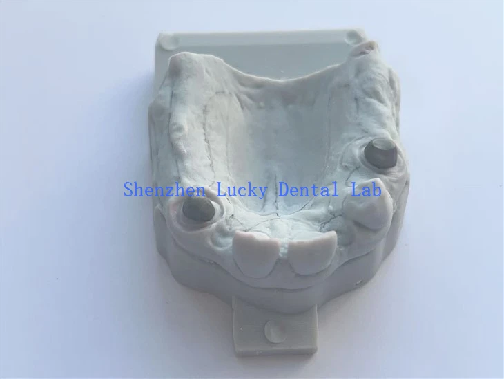 3D Stampa COCR Post Core