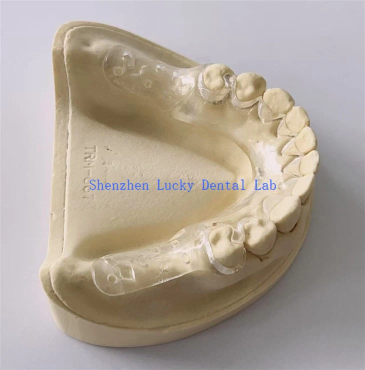 Qafas ċar ċar dentali magħmul fiċ-Ċina